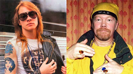 10 Career Lessons From Axl Rose